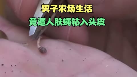 男子農場生活竟遭人膚蠅鑽進頭皮!